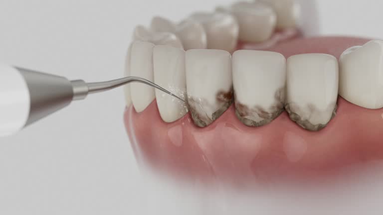 Reliable Dental contractor in Leona Valley, CA by Dentist Open Now